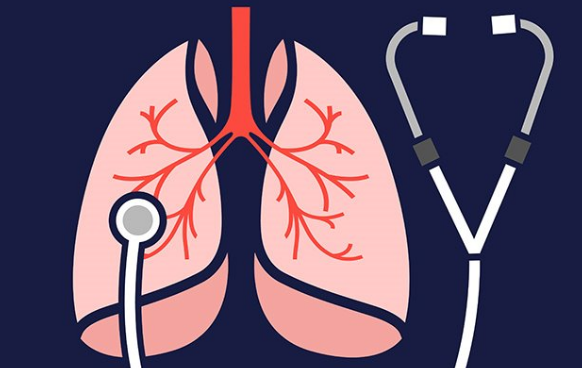 viêm phổi phế quản