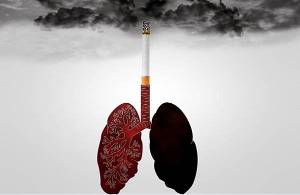 Hút thuốc lá có ung thư phổi không? Cách phòng ngừa ung thư phổi hiệu quả