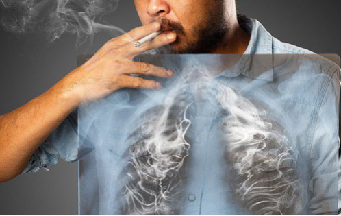 Khói thuốc khiến phổi bị nhiễm độc và tổn thương