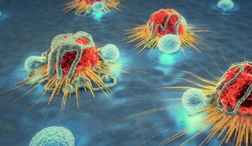 Tế bào NK phát hiện và tiêu diệt tế bào ung thư ngay từ đầu