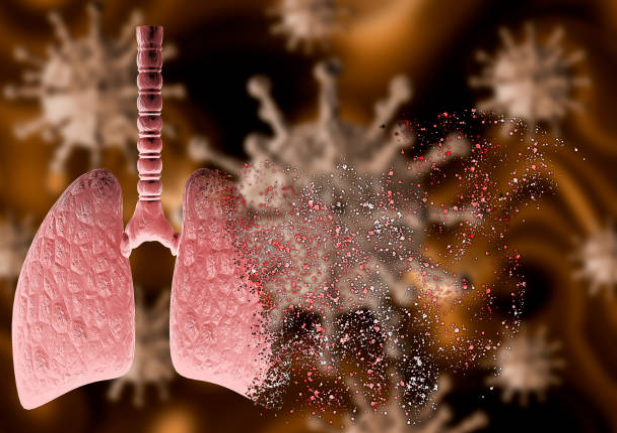 Phổi bị nhiễm độc và tổn thương là nguyên nhân hàng đầu gây các bệnh lý và triệu chứng trên phổi