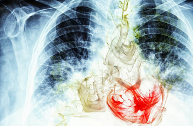 Trong khói thuốc có rất nhiều độc tố gây hại cho phổi