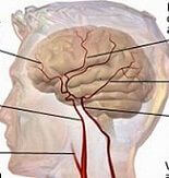 Bạn biết gì về tai biến mạch máu não?